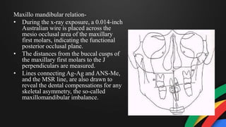 Maxillo mandibular relation-
• During the x-ray exposure, a 0.014-inch
Australian wire is placed across the
mesio occlusal area of the maxillary
first molars, indicating the functional
posterior occlusal plane.
• The distances from the buccal cusps of
the maxillary first molars to the J
perpendiculars are measured.
• Lines connecting Ag-Ag and ANS-Me,
and the MSR line, are also drawn to
reveal the dental compensations for any
skeletal asymmetry, the so-called
maxillomandibular imbalance.
 