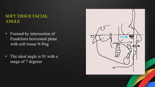 SOFT TISSUE FACIAL
ANGLE
• Formed by intersection of
Frankforts horizontal plane
with soft tissue N-Pog
• The ideal angle is 91 with a
range of 7 degrees
 