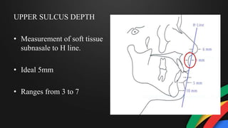 UPPER SULCUS DEPTH
• Measurement of soft tissue
subnasale to H line.
• Ideal 5mm
• Ranges from 3 to 7
 