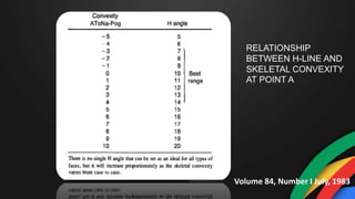 RELATIONSHIP
BETWEEN H-LINE AND
SKELETAL CONVEXITY
AT POINT A
Volume 84, Number I July, 1983
 