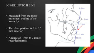LOWER LIP TO H LINE
• Measured from the most
prominent outline of the
lower lip
• The ideal position is 0 to 0.5
mm anterior
• A range of -1mm to 2 mm is
regarded normal
 