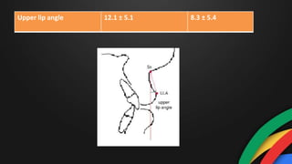 Upper lip angle 12.1 ± 5.1 8.3 ± 5.4
 