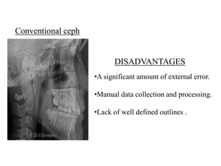Cephalometric analysis natarajan | PPTX