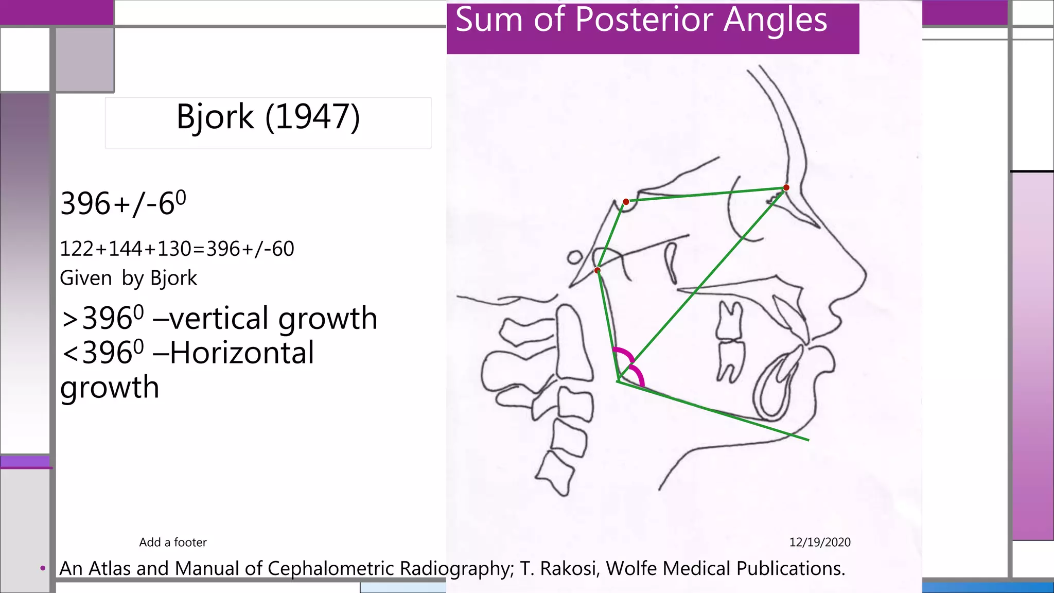 396+/-60
122+144+130=396+/-60
Given by Bjork
>3960 –vertical growth
<3960 –Horizontal
growth
Sum of Posterior Angles
• An Atlas and Manual of Cephalometric Radiography; T. Rakosi, Wolfe Medical Publications.
Bjork (1947)
12/19/2020Add a footer
 