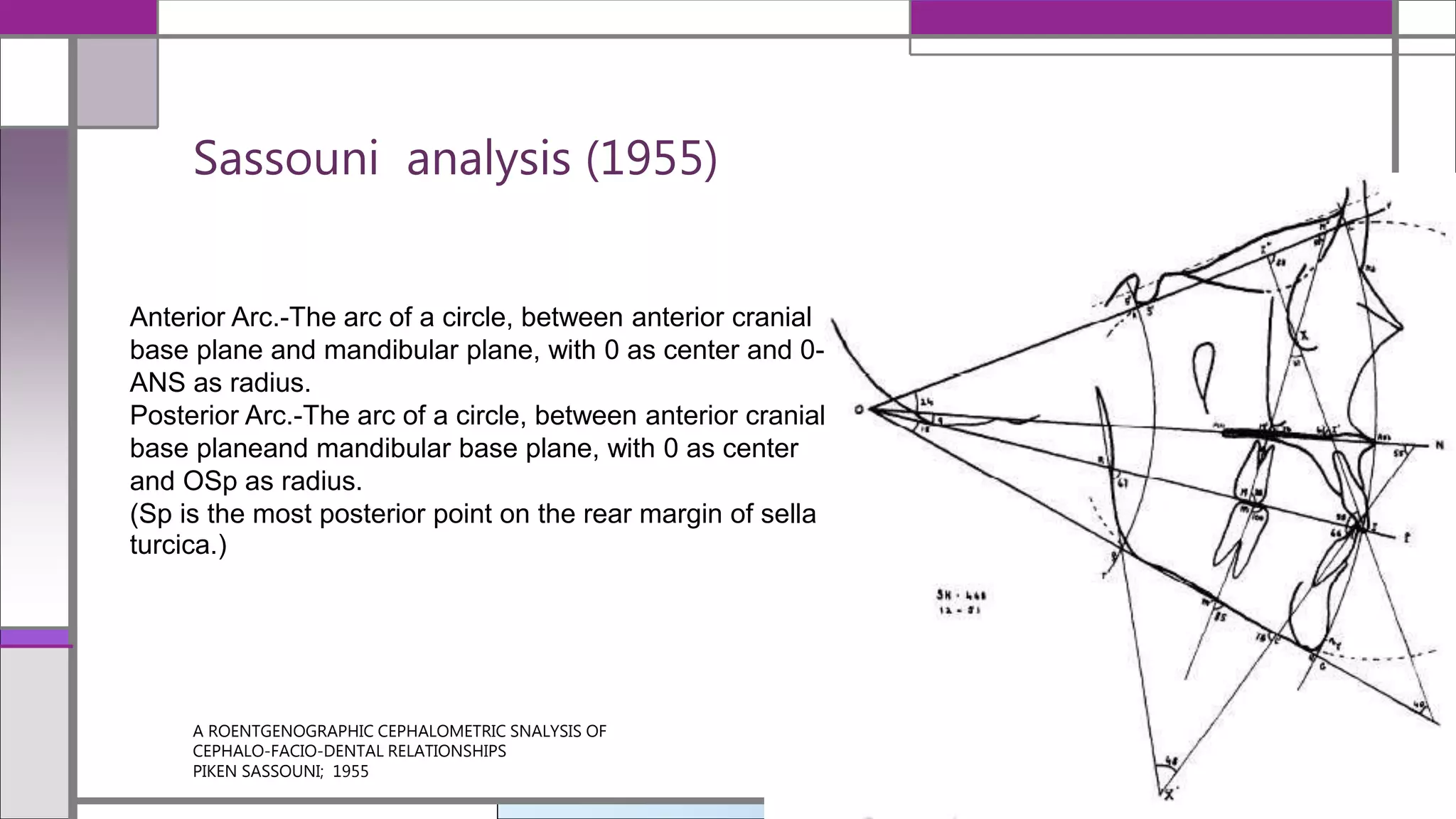 Sassouni analysis (1955)
A ROENTGENOGRAPHIC CEPHALOMETRIC SNALYSIS OF
CEPHALO-FACIO-DENTAL RELATIONSHIPS
PIKEN SASSOUNI; 1955
12/19/2020
Anterior Arc.-The arc of a circle, between anterior cranial
base plane and mandibular plane, with 0 as center and 0-
ANS as radius.
Posterior Arc.-The arc of a circle, between anterior cranial
base planeand mandibular base plane, with 0 as center
and OSp as radius.
(Sp is the most posterior point on the rear margin of sella
turcica.)
 