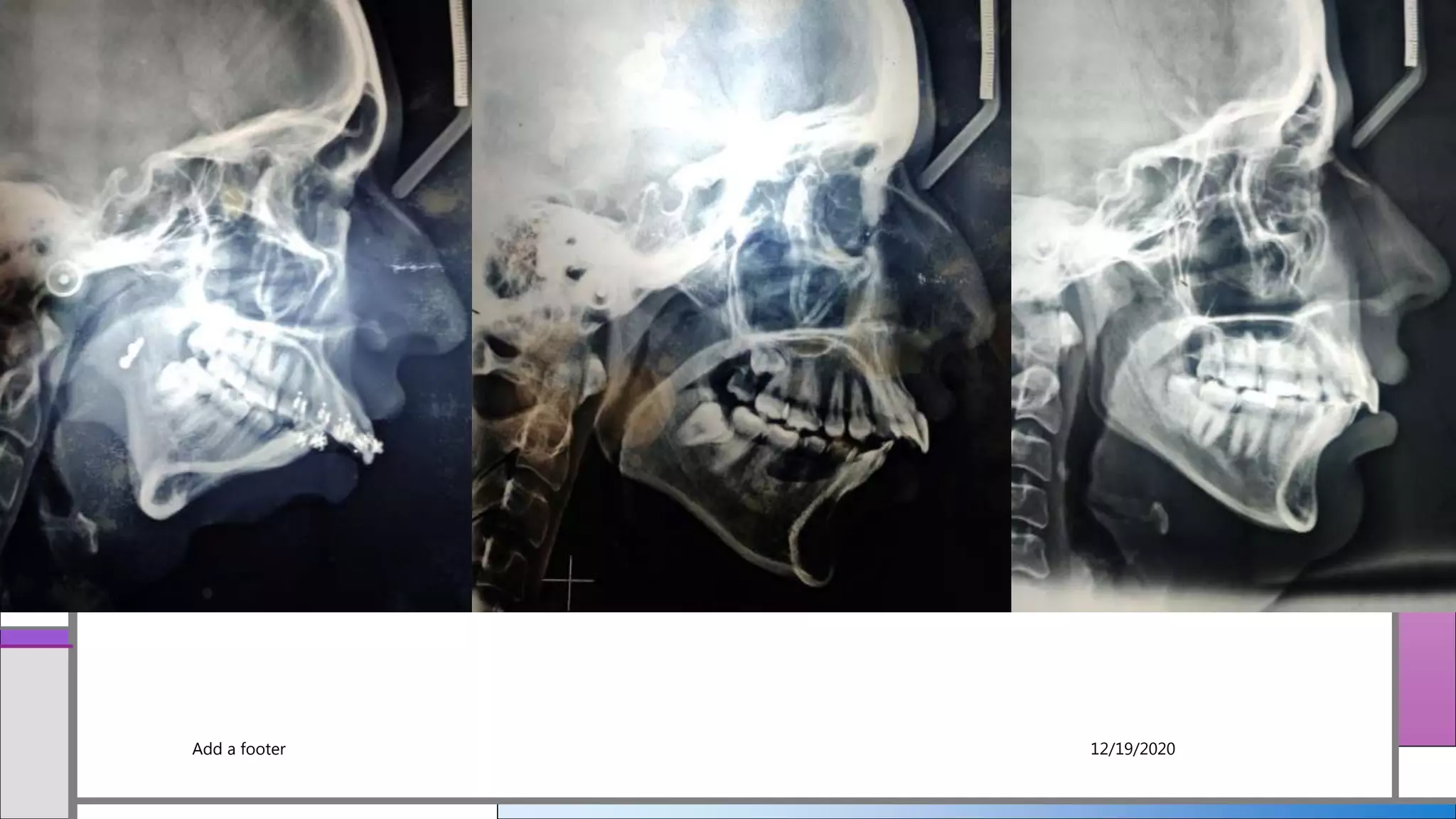 Add a footer 12/19/2020
 