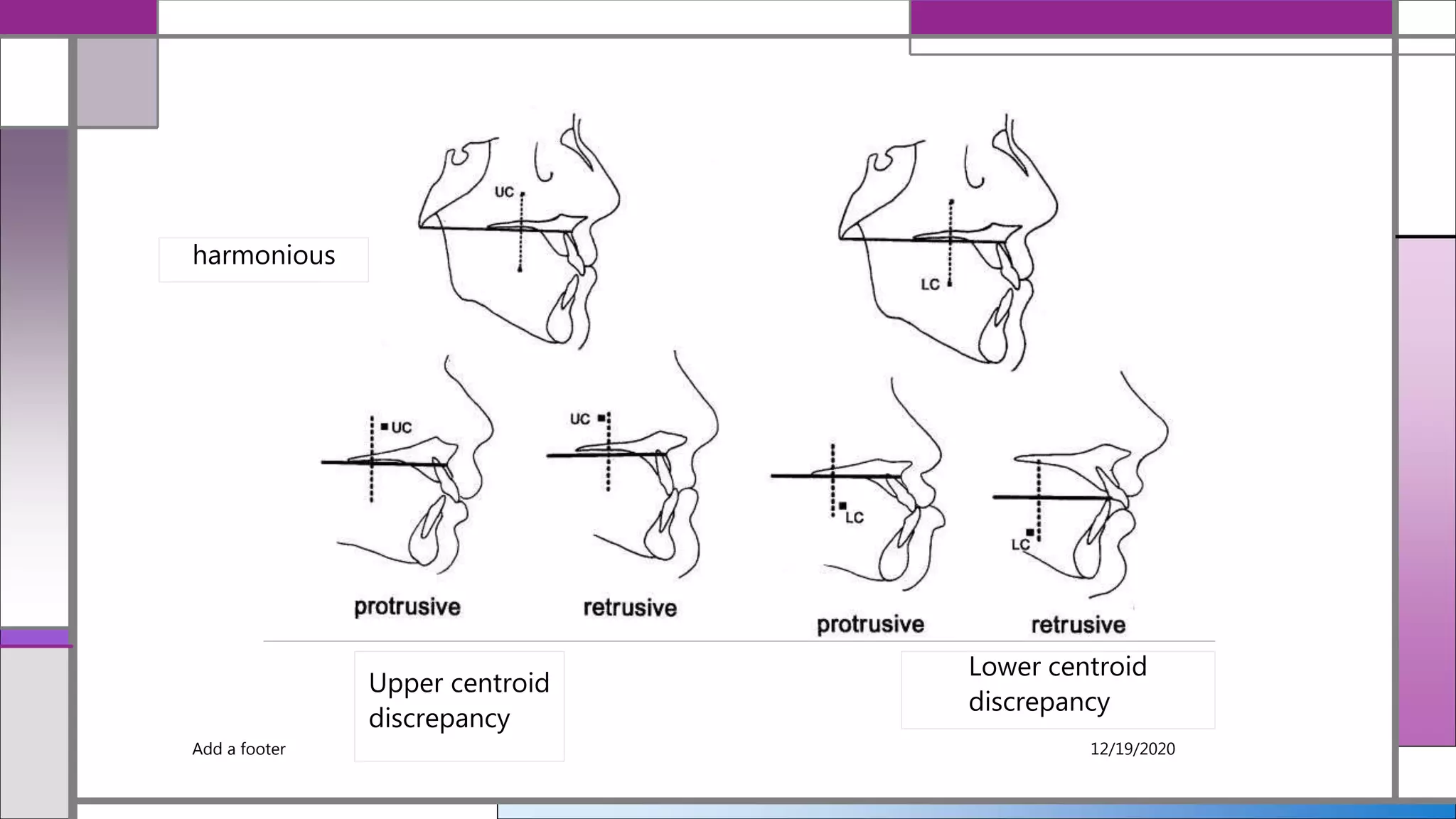 Add a footer 12/19/2020
harmonious
Upper centroid
discrepancy
Lower centroid
discrepancy
 