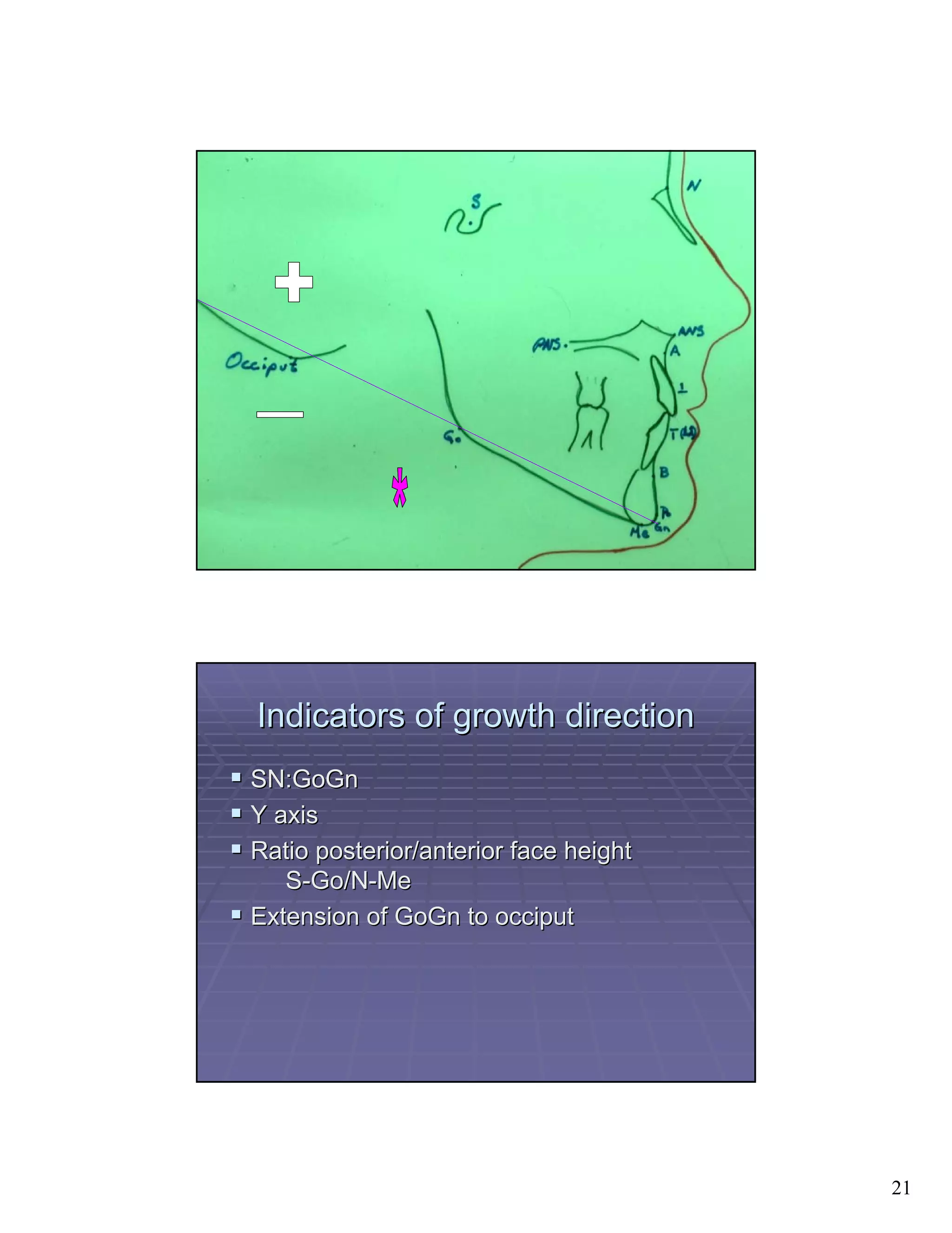 Indicators of growth direction
SN:GoGn
Y axis
Ratio posterior/anterior face height
   S-Go/N-Me
Extension of GoGn to occiput




                                       21
 