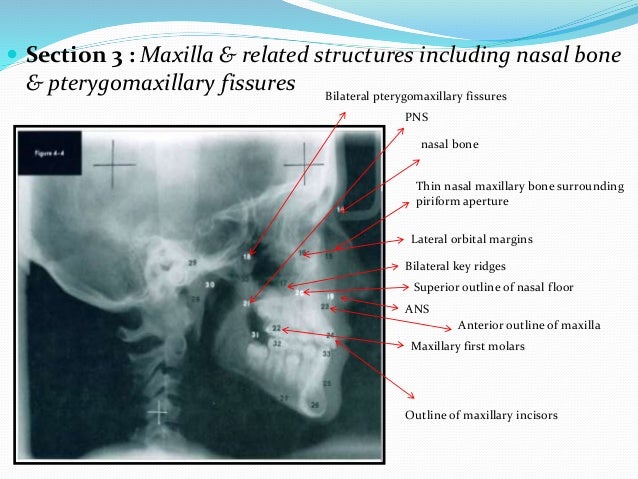 Cephalometrics