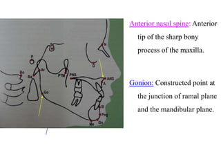 Anterior nasal spine: Anterior
tip of the sharp bony
process of the maxilla.
Gonion: Constructed point at
the junction of ramal plane
and the mandibular plane.
 