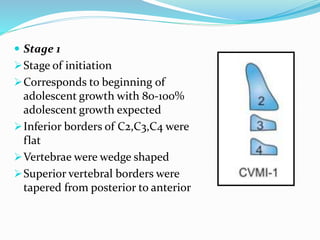  Stage 1
Stage of initiation
Corresponds to beginning of
adolescent growth with 80-100%
adolescent growth expected
Inferior borders of C2,C3,C4 were
flat
Vertebrae were wedge shaped
Superior vertebral borders were
tapered from posterior to anterior
 