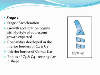  Stage 2
 Stage of acceleration
 Growth acceleration begins
with 65-85% of adolescent
growth expected
 Concavities developed in the
inferior borders of C2 & C3
 Inferior border of C4 was flat
 Bodies of C3 & C4– rectangular
in shape
 