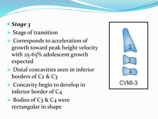  Stage 3
 Stage of transition
 Corresponds to acceleration of
growth toward peak height velocity
with 25-65% adolescent growth
expected
 Distal concavities seen in inferior
borders of C2 & C3
 Concavity begin to develop in
inferior border of C4
 Bodies of C3 & C4 were
rectangular in shape
 
