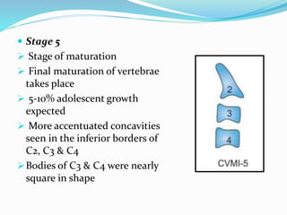  Stage 5
 Stage of maturation
 Final maturation of vertebrae
takes place
 5-10% adolescent growth
expected
 More accentuated concavities
seen in the inferior borders of
C2, C3 & C4
Bodies of C3 & C4 were nearly
square in shape
 