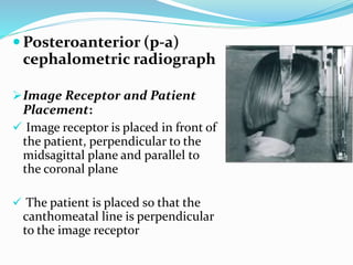  Posteroanterior (p-a)
cephalometric radiograph
Image Receptor and Patient
Placement:
 Image receptor is placed in front of
the patient, perpendicular to the
midsagittal plane and parallel to
the coronal plane
 The patient is placed so that the
canthomeatal line is perpendicular
to the image receptor
 
