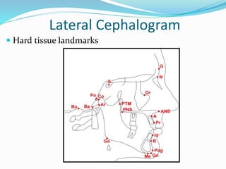 Lateral Cephalogram
 Hard tissue landmarks
 