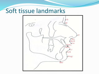 Soft tissue landmarks
 