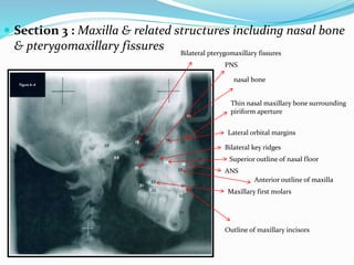  Section 3 : Maxilla & related structures including nasal bone
& pterygomaxillary fissures
nasal bone
Thin nasal maxillary bone surrounding
piriform aperture
Lateral orbital margins
Bilateral key ridges
Bilateral pterygomaxillary fissures
ANS
Superior outline of nasal floor
PNS
Anterior outline of maxilla
Outline of maxillary incisors
Maxillary first molars
 