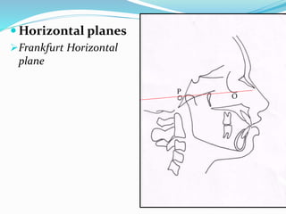  Horizontal planes
Frankfurt Horizontal
plane
P
O
 