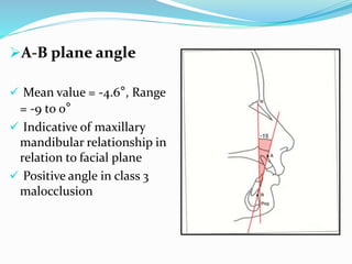A-B plane angle
 Mean value = -4.6°, Range
= -9 to 0°
 Indicative of maxillary
mandibular relationship in
relation to facial plane
 Positive angle in class 3
malocclusion
 