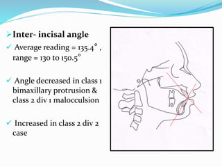 Inter- incisal angle
 Average reading = 135.4° ,
range = 130 to 150.5°
 Angle decreased in class 1
bimaxillary protrusion &
class 2 div 1 malocculsion
 Increased in class 2 div 2
case
 