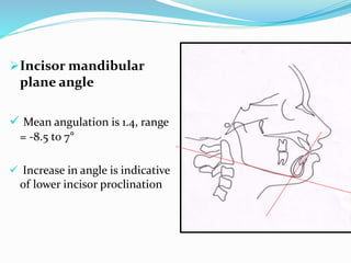 Incisor mandibular
plane angle
 Mean angulation is 1.4, range
= -8.5 to 7°
 Increase in angle is indicative
of lower incisor proclination
 
