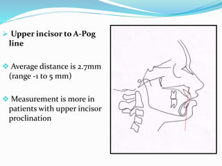  Upper incisor to A-Pog
line
 Average distance is 2.7mm
(range -1 to 5 mm)
 Measurement is more in
patients with upper incisor
proclination
 