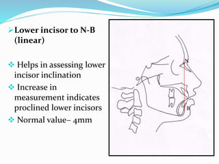 Lower incisor to N-B
(linear)
 Helps in assessing lower
incisor inclination
 Increase in
measurement indicates
proclined lower incisors
 Normal value– 4mm
N
B
 
