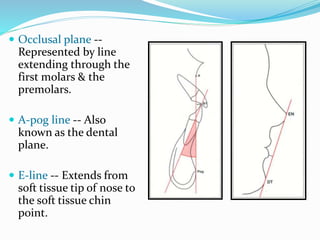  Occlusal plane --
Represented by line
extending through the
first molars & the
premolars.
 A-pog line -- Also
known as the dental
plane.
 E-line -- Extends from
soft tissue tip of nose to
the soft tissue chin
point.
 