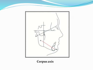 Corpus axis
 
