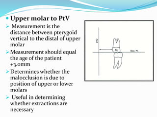  Upper molar to PtV
 Measurement is the
distance between pterygoid
vertical to the distal of upper
molar
Measurement should equal
the age of the patient
+3.0mm
Determines whether the
malocclusion is due to
position of upper or lower
molars
 Useful in determining
whether extractions are
necessary
 