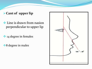 Cant of upper lip
 Line is drawn from nasion
perpendicular to upper lip
 14 degree in females
8 degree in males
 
