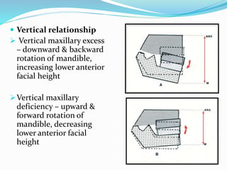  Vertical relationship
 Vertical maxillary excess
– downward & backward
rotation of mandible,
increasing lower anterior
facial height
Vertical maxillary
deficiency – upward &
forward rotation of
mandible, decreasing
lower anterior facial
height
 