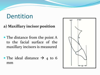 Dentition
a) Maxillary incisor position
 The distance from the point A
to the facial surface of the
maxillary incisors is measured
 The ideal distance  4 to 6
mm
 
