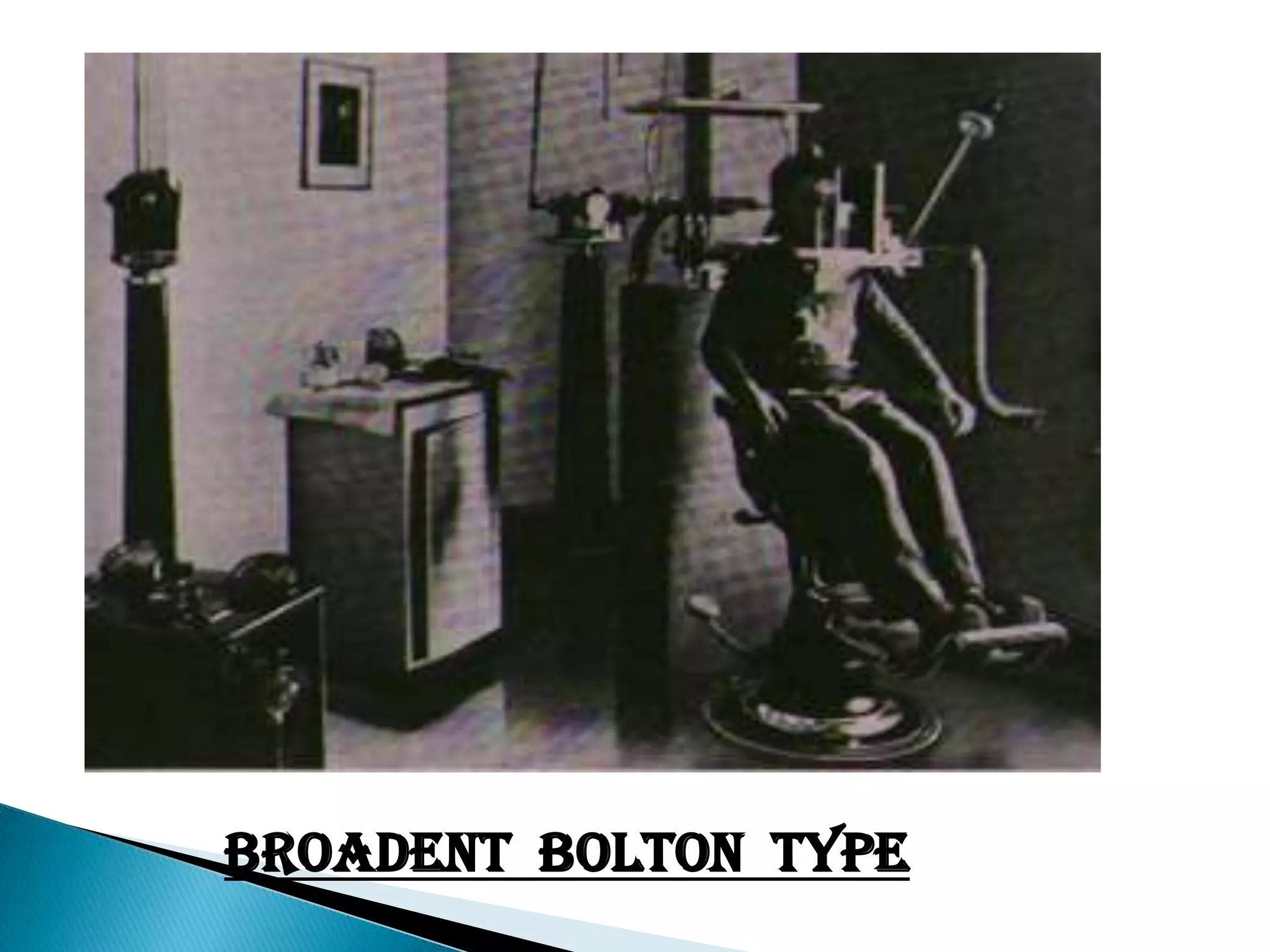 But it was BROADENT(USA) and HOFRATH(Germany) who introduced and popularized in 1931.