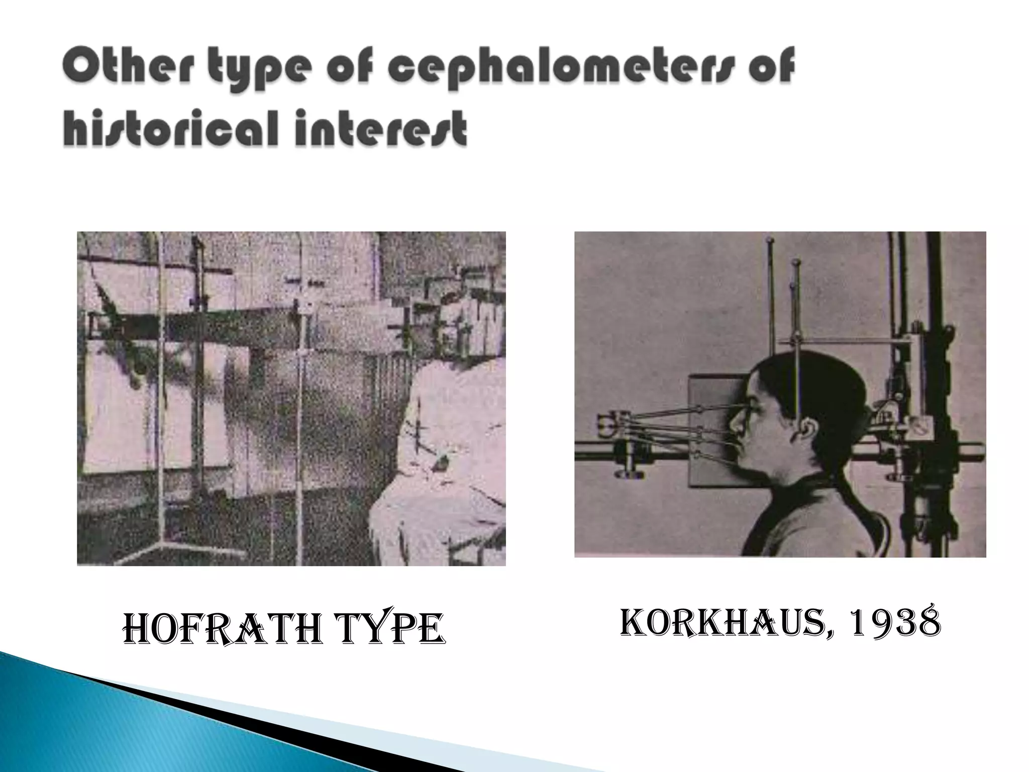 Broadent  bolton  type: Uses two x ray sources and two film holders.