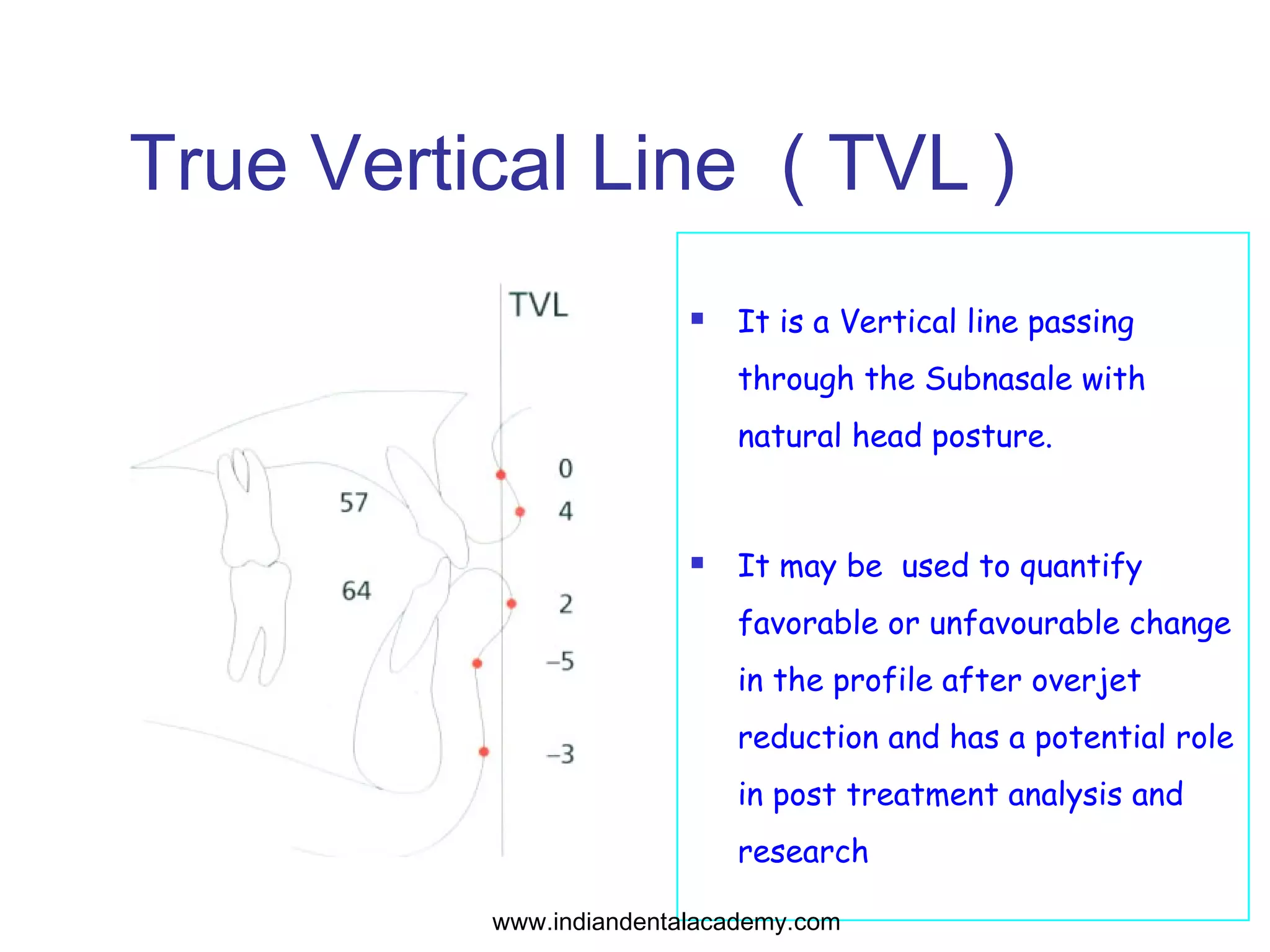 Cephalometrics for orthognathic surgery