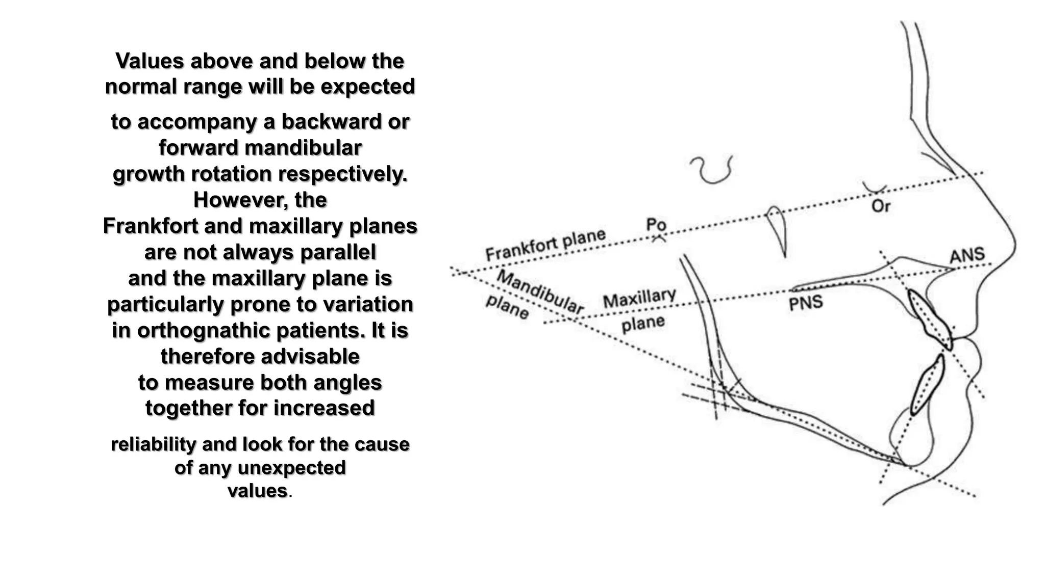 Maxillary Plane Rotation Cephalometrics for orthognathic surgery part 2 | PPTX