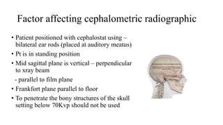 Cephalometrics analysis | PPTX