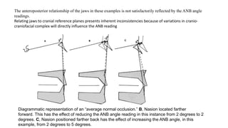 Cephalometrics analysis | PPTX