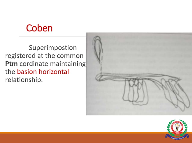 CEPHALOMETRIC SUPERIMPOSITION.ppt | Dental Health | Diseases and Conditions