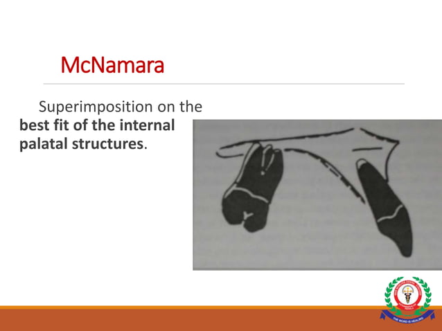 CEPHALOMETRIC SUPERIMPOSITION.ppt | Dental Health | Diseases and Conditions