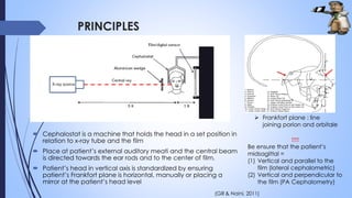 Cephalometry | PPTX