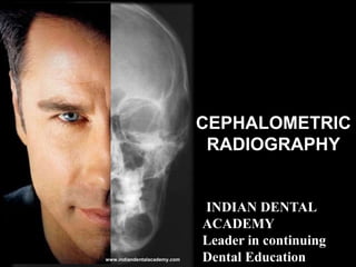 CEPHALOMETRIC
RADIOGRAPHY
INDIAN DENTAL
ACADEMY
Leader in continuing
Dental Educationwww.indiandentalacademy.com
 