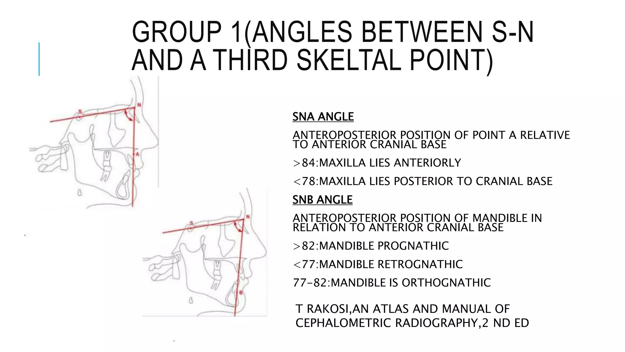 Cephalometry 1 | PPT