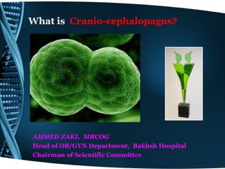 What is Cranio-cephalopagus?




AHMED ZAKI, MRCOG
Head of OB/GYN Department, Bakhsh Hospital
Chairman of Scientific Committee
 