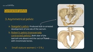 …contd.
3.Asymmetrical pelvis:
a. Naegele's pelvis: Produced due to arrested
development of one ala of the sacrum.
b. Robert's pelvis (transversely
contracted pelvis): Both alae of the
sacrum are absent and the sacrum fused
with innominate bones.
4. Small stature women ( < 5 ft.)
Contracted pelvis;
 