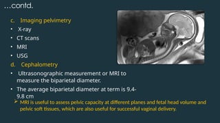 …contd.
c. Imaging pelvimetry
• X-ray
• CT scans
• MRI
• USG
d. Cephalometry
• Ultrasonographic measurement or MRI to
measure the biparietal diameter.
• The average biparietal diameter at term is 9.4-
9.8 cm
 MRI is useful to assess pelvic capacity at different planes and fetal head volume and
pelvic soft tissues, which are also useful for successful vaginal delivery.
 