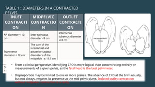 INLET
CONTRACTI
ON
MIDPELVIC
CONTRACTIO
N
OUTLET
CONTRACTI
ON
AP diameter < 10
cm
Inter spinuous
diameter <8 cm
Interischial
tuberous diameter
8 cm
≤
Transverse
diameter < 12 cm
The sum of the
interischial and
posterior sagittal
diameters of the
midpelvis 13.5 cm
≤
or less.
Diagonal conjugate
< 11 cm
TABLE 1 : DIAMETERS IN A CONTRACTED
PELVIS
• From a clinical perspective, identifying CPD is more logical than concentrating entirely on
measurements of a given pelvis, as the fetal head is the best pelvimeter.
• Disproportion may be limited to one or more planes. The absence of CPD at the brim usually,
but not always, negates its presence at the mid-pelvic plane. Isolated outlet contraction
without midpelvic contraction is a rarity.
 