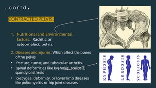 … c o n t d .
CONTRACTED PELVIS:
1. Nutritional and Environmental
factors: Rachitic or
osteomalacic pelvis.
2. Diseases and injuries: Which affect the bones
of the pelvis
• fracture, tumor, and tubercular arthritis.
• spinal deformities like kyphosis, scoliosis,
spondylolisthesis
• coccygeal deformity, or lower limb diseases
like poliomyelitis or hip joint diseases
 